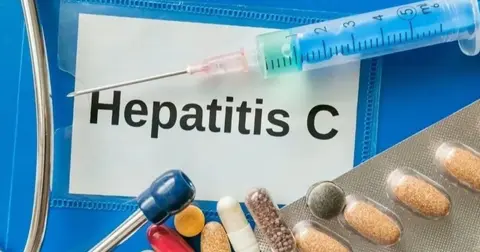Türkiye’de 750 bin kişiye kadar Hepatit C taşıyıcısı olabilir... Hepatit C'nin gerçek yüzü!
